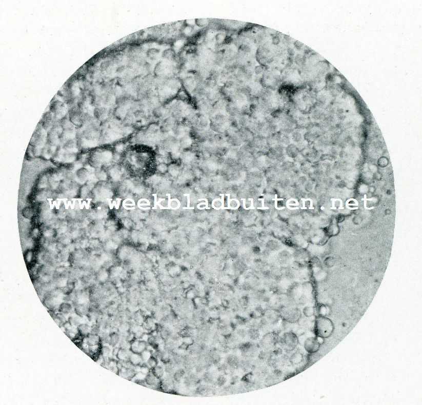 Het microscoop en de boterbereiding. Een korreltje bogter ontnomen aan de karn, op het oogenblik dat de botervorming zichtbaar wordt: ('t schiften begint). Vergrooting 650 maal