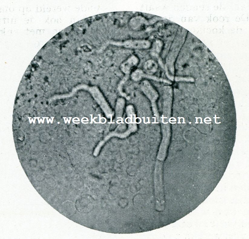 Het microscoop en de boterbereiding. Boter met schimmel (Odium lactis) doorgroeid. Ronde en cilindrische schimmelsporen zijn bezig te ontkiemen. Vergrooting 650 maal