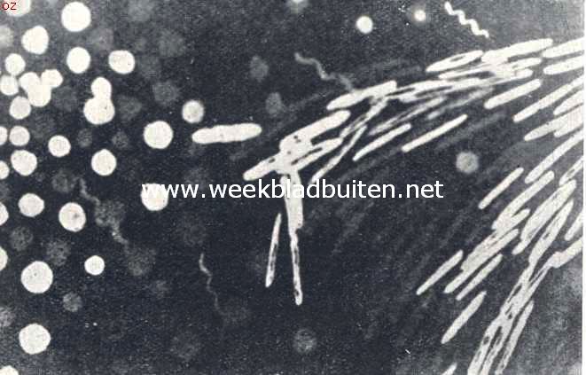 Kogel- en staafbacterin bij 2000-malige vergrooting