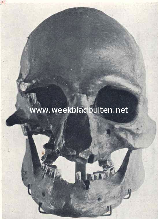 De schedel van Oberkassel, afkomstig van een Cromagnonmensch. Men lette op de recente trekken en de kin